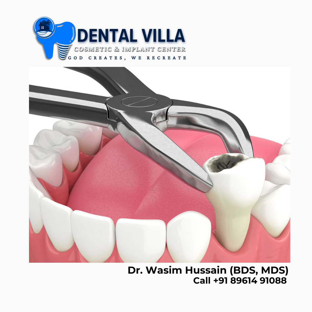 best teeth extraction kolkata