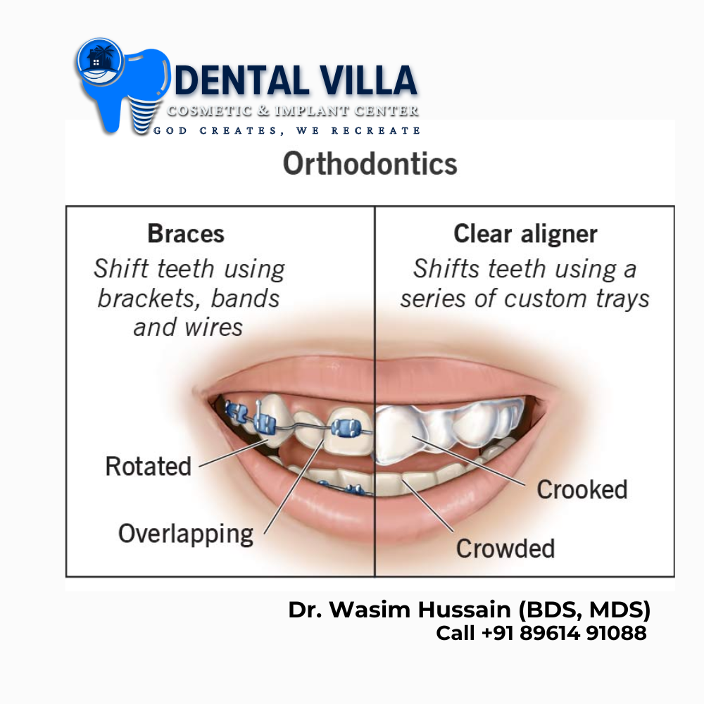 Orthodontic Correction braaces & aligners at dental villa Howrah