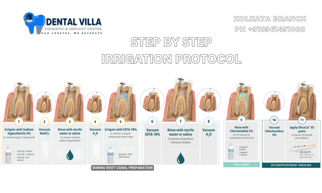 2-Hole Endo Irrigation Tips For Root Canal Treatment – Dental Irrigator Delivery Needles (Pack)
